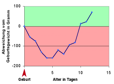 Ein kurzfristiger Gewichtsverlust nach der Geburt ist normal.