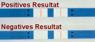 Ablesen des Resultats