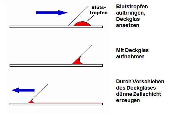 Herstellung eines Blutausstrichs