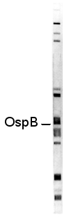 Borrelien Immunoblot