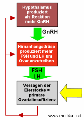 Bei primrer Ovarialinsuffizienz (Ovarfunktion gestrt) sind die Gonadotropine erhht