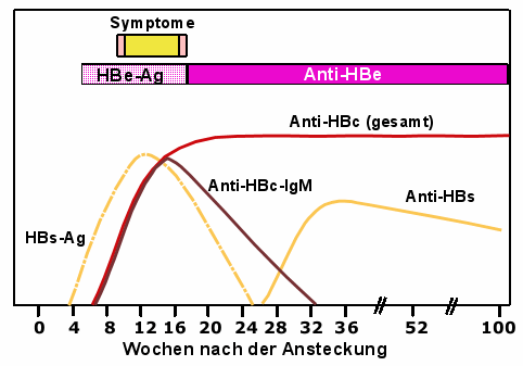 Verlauf wichtiger Laborwerte bei akuter Hepatitis B