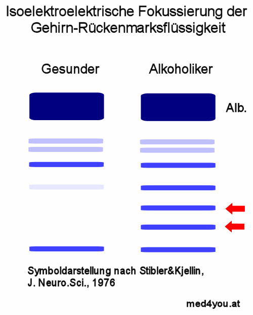 Bei Alkoholikern fanden Stibler&Kjellin 1976 zusätzliche Eiweißbanden in der isoelektriwchen Fokussierung.