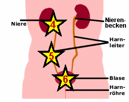 Ursachen einer Proteinurie "nach der Niere", d.h. nach Nierenfilter und Nierenrhrchen