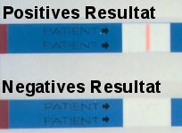 Oben positives Resultat, unten negatives.