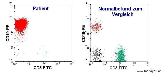 Vergleich der T- und B-Lymphozyten bei Patient und Gesundem