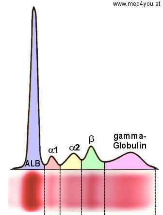 Mit Hilfe eines Scanners oder eines Densitometers (eine Art Photometer) entsteht eine Elektrophoresekurve.