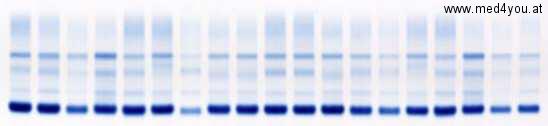 Eine Bahn des Agarose-Gels mit 20 Eiwei-Elektrophoresen