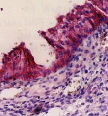 Histologisches Prparat mit immunhistochemischer Frbung (rot)