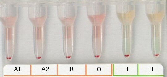 Serumgegenprobe Blutgruppe AB