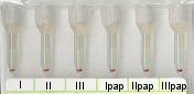 Negatives Antikrper-Screening in Liss/Coombs bei 37 C