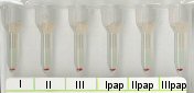 Negatives Antikrper-Screening in Liss/Coombs bei 37 C