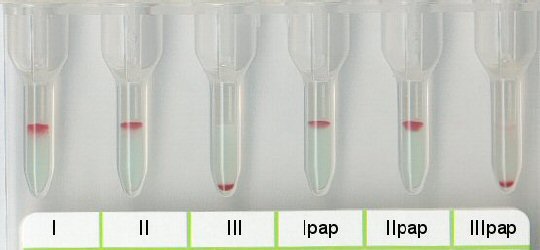 Postitive Reaktion im Antikrper-Screening