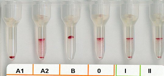 Serumgegenprobe bei Anti H