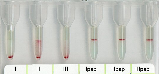 Antikrper-Screening 37 C bei Anti H (mit Temperaturamplitude bis 37 C!)