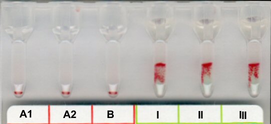 Positives Antikrper-Screening bei Raumtemperatur