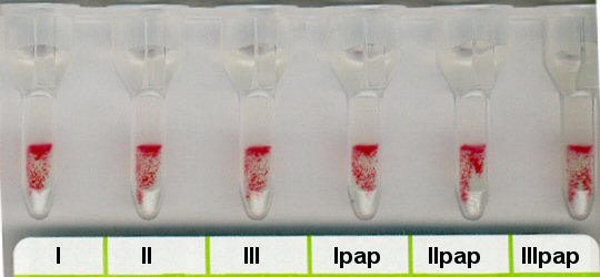 Positives Antikrper-Screening bei 37 C