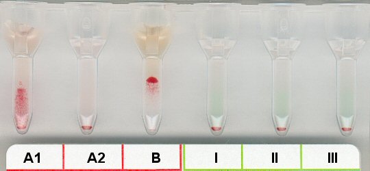 Serumgegenprobe bei 4 C