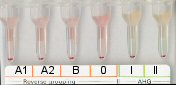 Serumgegenprobe (A1, A2, B und 0-Zellen) bei Blutgruppe AB inkl. Antikrperscreening bei Raumtemperatur