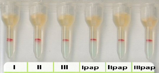 Antikrper-Screening bei 37 C bei Bombay-Typ