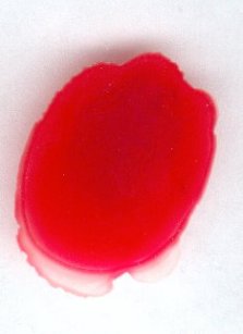 Negative Reaktion von roten Blutkrperchen auf einer Glasplatte