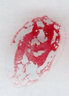 Positive Reaktion von Antikrper und roten Blutkrperchen auf einer Glasplatte
