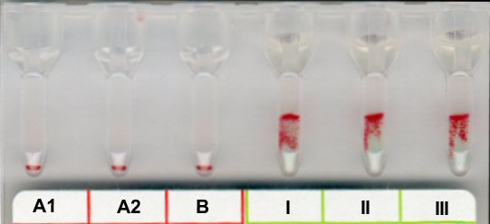 Positives Antikrper-Screening bei Raumtemperatur