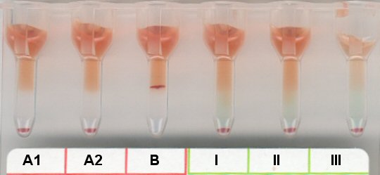 Serumgegenprobe Blutgruppe A