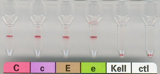 Rhesusuntergruppe CcEe, Kell negativ
